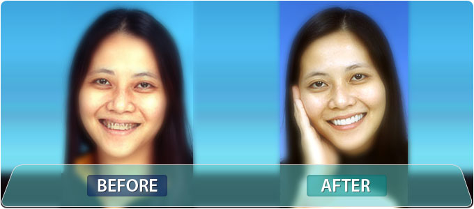 Fine Dentistry by Design Patient Photo Gallery